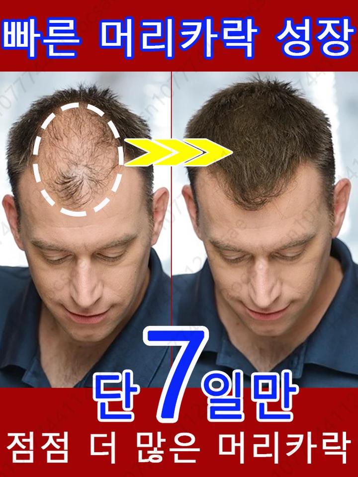 1 Ͽ + 10cm Ӹī 